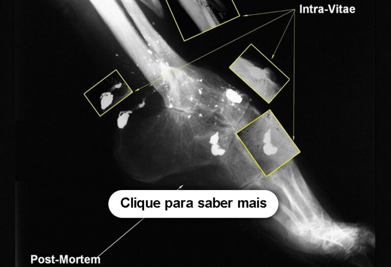 Introdução à Identificação Humana Odontológica e Antropológica